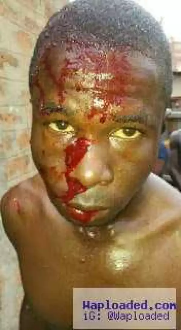 Commercial Motorcyclist Stabbed In The Head By Robbers (Photo)